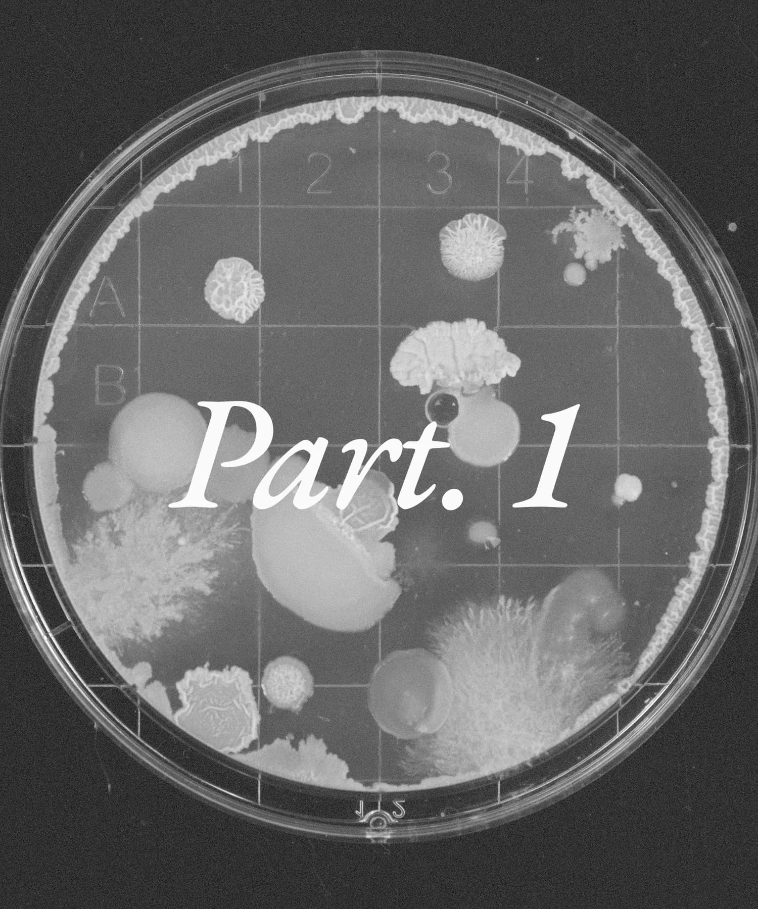Part. 1 Autoimmune Disease Machine Learning Challenge