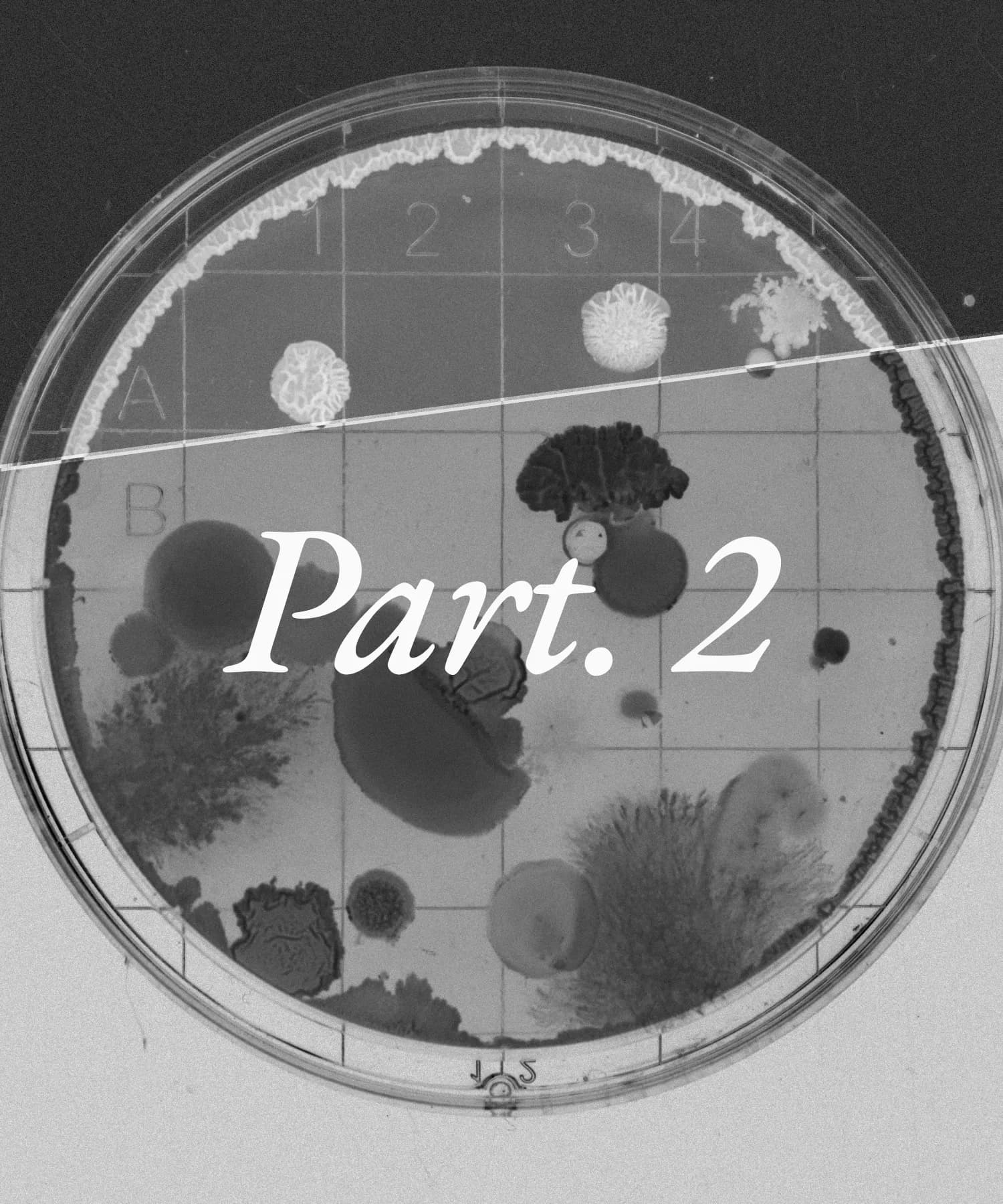 Part. 2 Autoimmune Disease Machine Learning Challenge